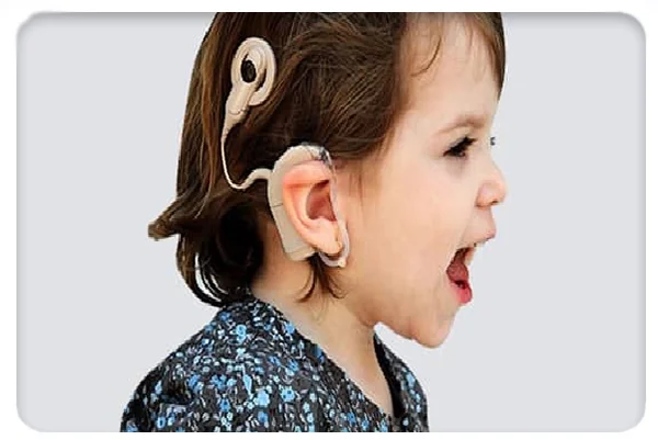 Cochlear Implant Surgery