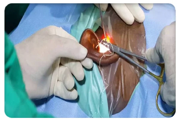 Advanced Microscopic and Endoscopic Ear Surgery