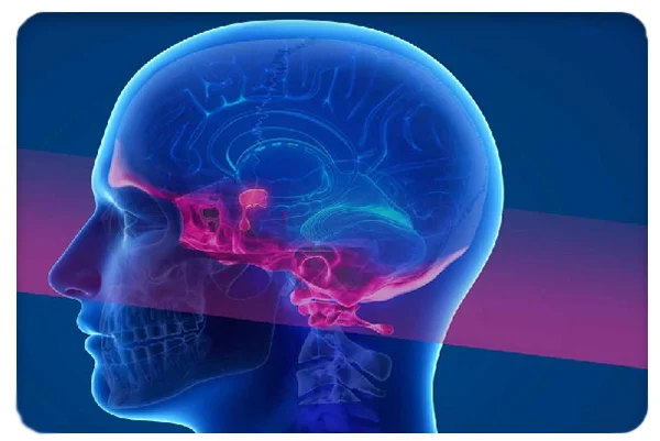 Lateral and Anterior Skull Base Surgery